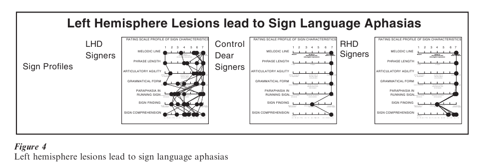 sign language translation research paper